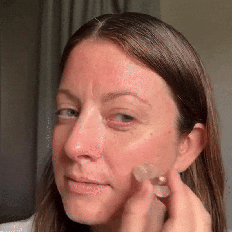 Anti aging - Micro Infusion Facial System